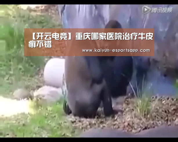 【开云电竞】重庆哪家医院治疗牛皮癣不错(图1) 开云真人